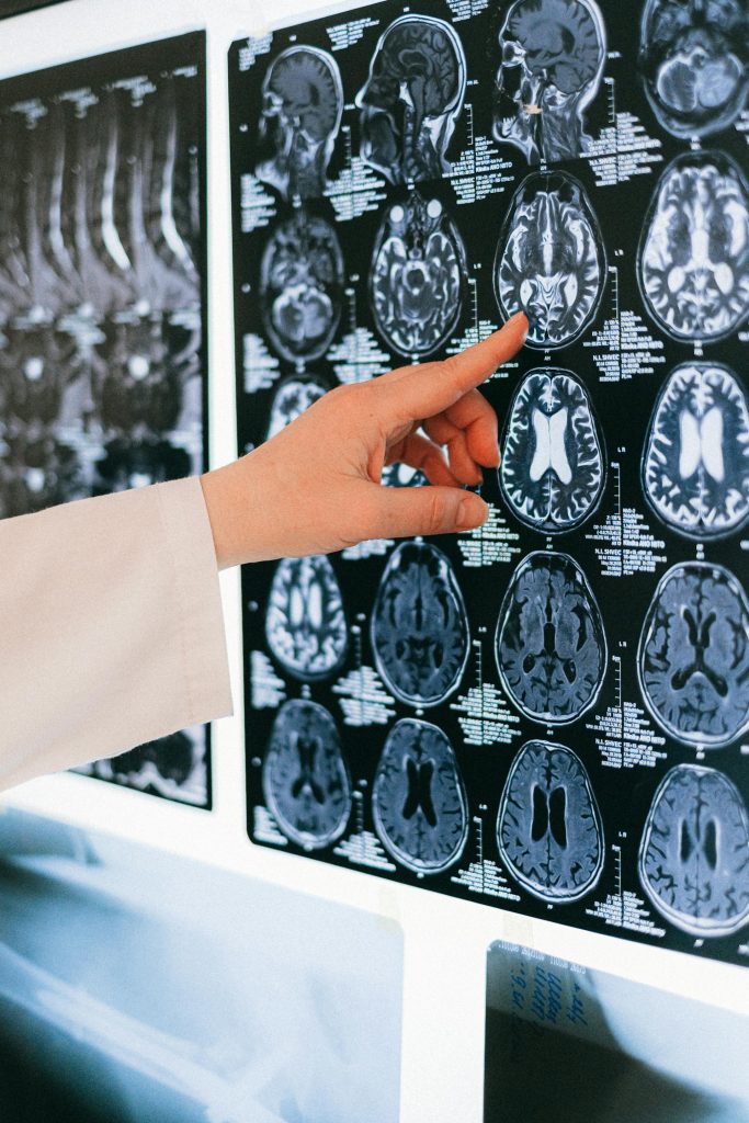 False memorie e ricordi che non sono mai accaduti